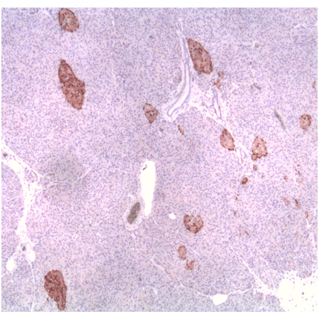 Chromogranin A (human) monoclonal antibody (PHE5) Immunohistochemistry