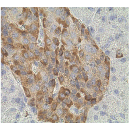 Chromogranin A (human) monoclonal antibody (PHE5) Immunohistochemistry