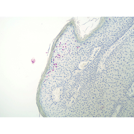 DIGX® HPV type 6/11 probe 10x