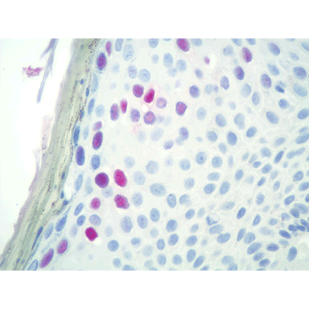 DIGX® HPV type 6/11 probe 40X