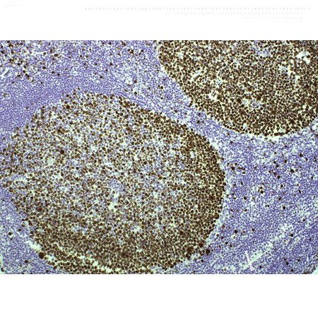 POLYVIEW® PLUS HRP-DAB (Anti-Rabbit) Kit GAR_MIB-1_tonsil
