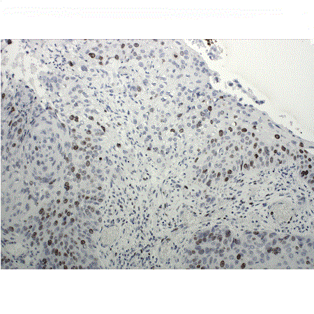 POLYVIEW® PLUS HRP-DAB (Anti-Mouse) Kit HRP_10X