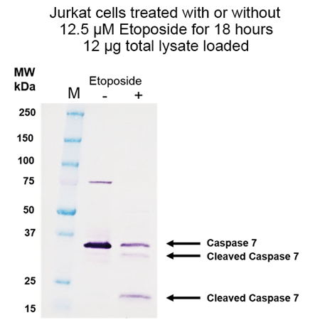 WESTERNVIEW Detection Kit (Anti-Rabbit) Western Blot Jurkat