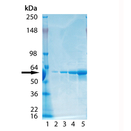 Diaphorase SDS-PAGE
