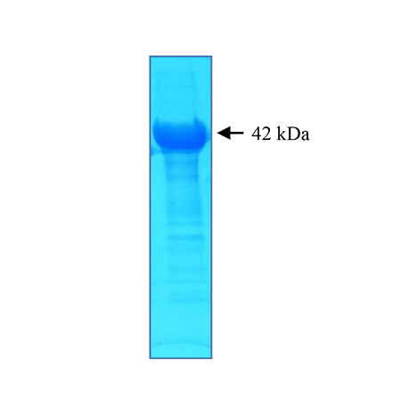 Coronavirus (hCoV-229E NP) antigen, (recombinant) (His-tag) SDS-PAGE