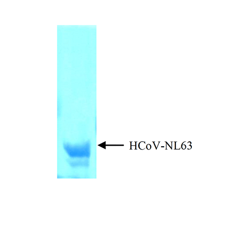 Coronavirus (CoV-NP-NL63) antigen, (recombinant) SDS-PAGE