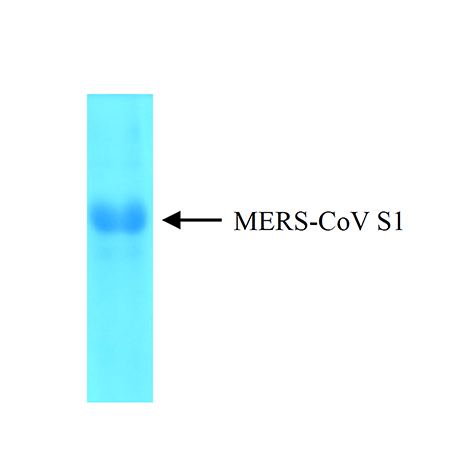 Coronavirus (MERS-CoV S1) antigen, (recombinant) (His-tag) SDS-PAGE