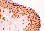 Cdk1/cdc2 monoclonal antibody (5F6) Immunohistochemistry