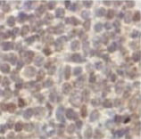 Cyclin D1 monoclonal antibody (5D4) Immunohistochemistry