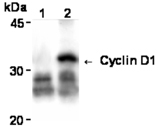 Cyclin D1 monoclonal antibody (5D4) Immunoprecipitation
