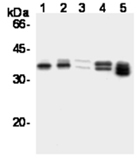 Cyclin D1 monoclonal antibody (5D4) Western blot