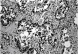DNA-topoisomerase II α monoclonal antibody (1C5) Immunohistochemistry