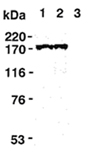 DNA-topoisomerase II α monoclonal antibody (1C5) Western blot