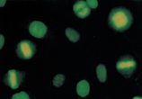 [pThr1342]DNA-topoisomerase II α monoclonal antibody (3D4) Immunocytochemistry