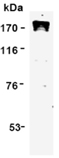 [pThr1342]DNA-topoisomerase II α monoclonal antibody (3D4) Western blot