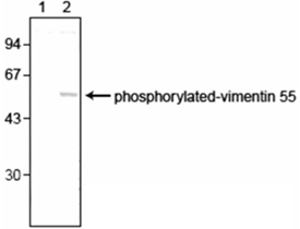 [pSer55]Vimentin monoclonal antibody (4A4) Western blot