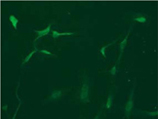 [pSer71]Vimentin monoclonal antibody (TM71) Immunocytochemistry