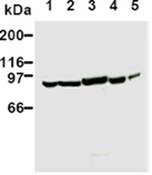 PI3 kinase monoclonal antibody (AB6) Western blot