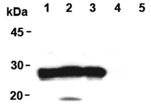 DJ-1 monoclonal antibody (3E8) Western blot