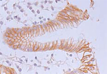 β-Catenin monoclonal antibody (12F7) Immunohistochemistry
