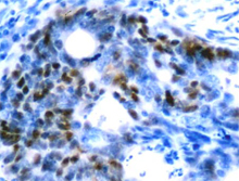 β-Catenin monoclonal antibody (12F7) Immunohistochemistry