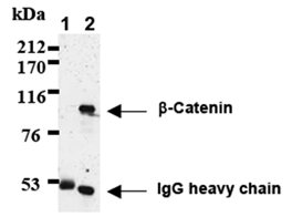 β-Catenin monoclonal antibody (12F7) Immunoprecipitation