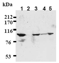 β-Catenin monoclonal antibody (12F7) Western blot