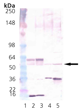 CaMKII polyclonal antibody Western blot