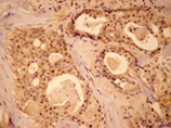 MEK1 polyclonal antibody Immunohistochemistry