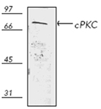 PKC polyclonal antibody Western blot