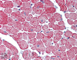 Akt polyclonal antibody Immunohistochemistry
