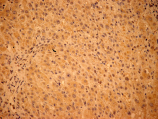 PDK1 polyclonal antibody Immunohistochemistry