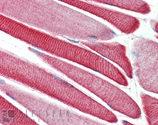 GSK-3β polyclonal antibody Immunohistochemistry