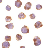 IRAK-4 polyclonal antibody Immunocytochemistry