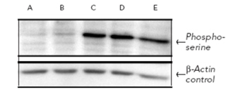 Phosphoserine polyclonal antibody Western blot
