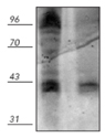 Phosphothreonine polyclonal antibody Western blot