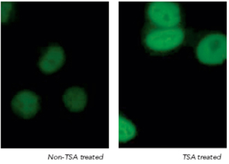 Acetylated Lysine polyclonal antibody Immunofluorescence