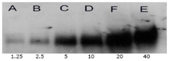 Acetylated Lysine polyclonal antibody Immunoprecipitation
