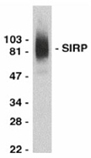 SHPS-1/SIRP-1 α polyclonal antibody Western blot