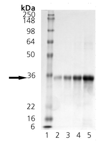 Dkk-1 (mouse), (recombinant) (His-tag) SDS-PAGE