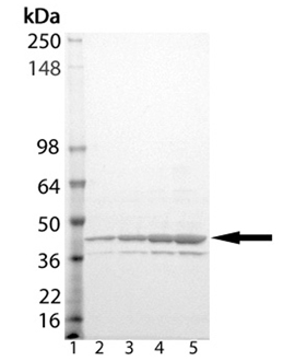 eIF2α (human), (recombinant) (His-tag) SDS-PAGE