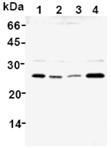 GST-P polyclonal antibody Western blot