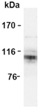 APP monoclonal antibody (3E9) Western blot