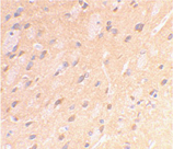 APP polyclonal antibody Immunohistochemistry