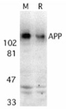 APP polyclonal antibody Western blot