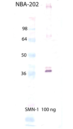 SMN1 monoclonal antibody (2B1) Western blot