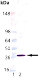 SMN1 (human), (recombinant) (His-tag) Western blot