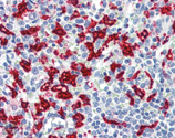 HO-1 monoclonal antibody (HO-1-1) Immunohistochemistry
