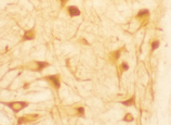 HO-1 monoclonal antibody (HO-1-2) Immunohistochemistry