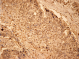 Cu/Zn SOD polyclonal antibody Immunohistochemistry